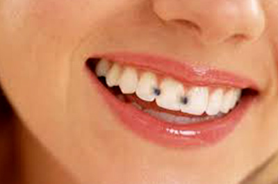 معاینه دندان دکتر فاطمه سالمی